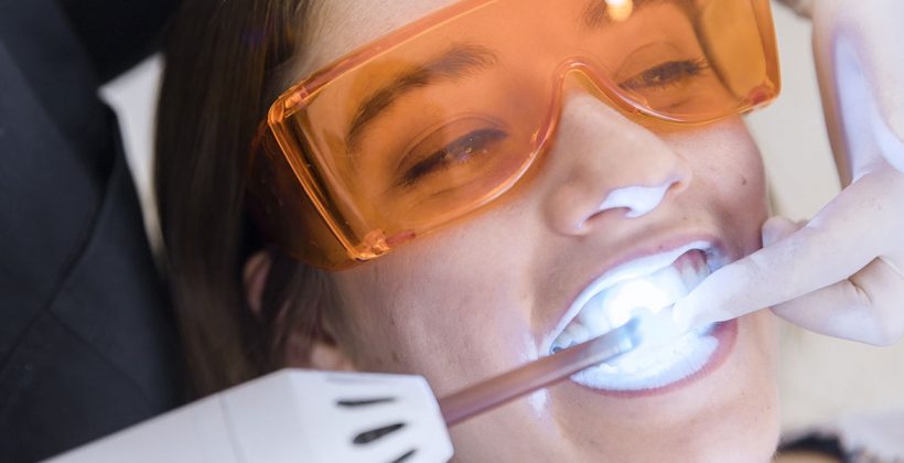 ¿Cómo elegir la clínica para blanqueamiento dental perfecta?